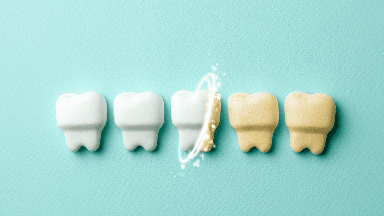 Kellastuttaako nuuska hampaita samalla tavalla kuin tupakka?